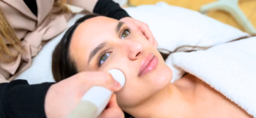 SUrante il tattamento di Biolifting con la radiofrequenza